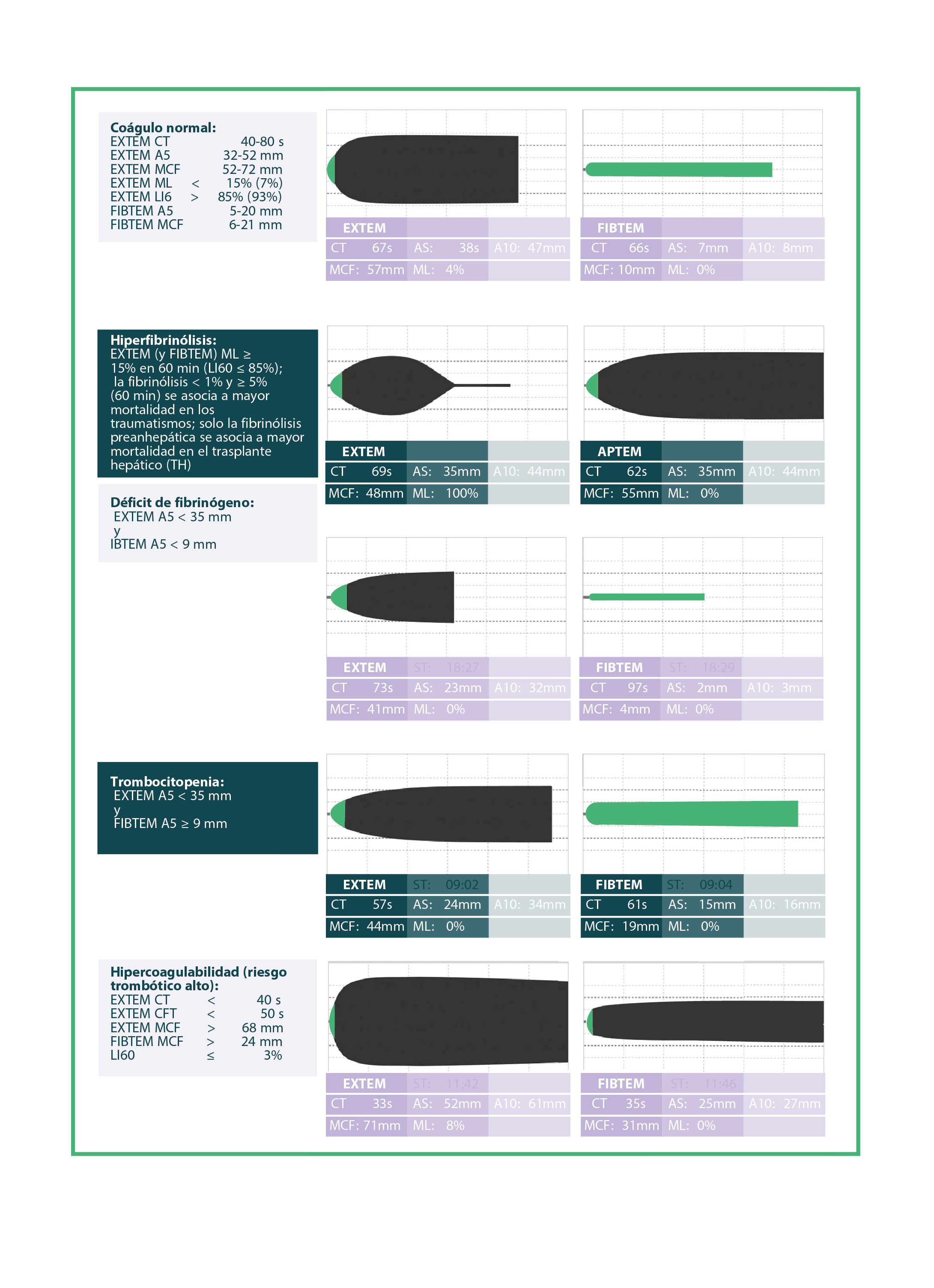ROTEM - Rotational Thromboelastometry | Prueba Viscoelástica Dinámica